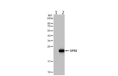Anti-Glutathione Peroxidase 2/GPX2 antibody (ab137431)