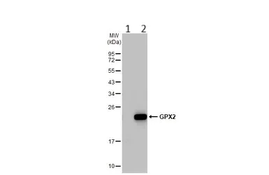 Western blot - Anti-Glutathione Peroxidase 2/GPX2 antibody (AB137431)