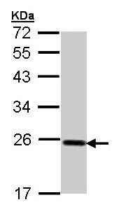 Western blot - Anti-Glutathione Peroxidase 2/GPX2 antibody (AB137431), expandable thumbnail