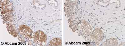 Immunohistochemistry (Formalin/PFA-fixed paraffin-embedded sections) - Anti-Glutathione Peroxidase 2/GPX2 antibody (AB64322)