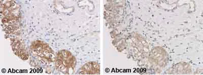 Immunohistochemistry (Formalin/PFA-fixed paraffin-embedded sections) - Anti-Glutathione Peroxidase 2/GPX2 antibody (AB64322)