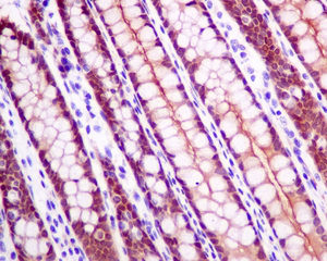 Immunohistochemistry (Formalin/PFA-fixed paraffin-embedded sections) - Anti-Glutathione Peroxidase 2/GPX2 antibody [EPR8175(2)] (AB140130)