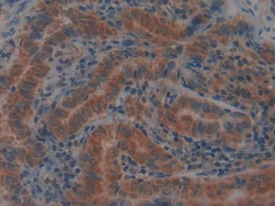 Immunohistochemistry (Formalin/PFA-fixed paraffin-embedded sections) - Anti-Glutathione Peroxidase 4 antibody (AB231174)