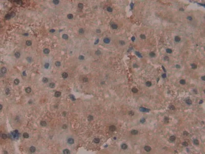 Immunohistochemistry (Formalin/PFA-fixed paraffin-embedded sections) - Anti-Glutathione Peroxidase 4 antibody (AB231174)