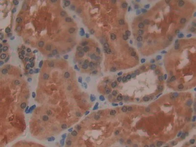 Immunohistochemistry (Formalin/PFA-fixed paraffin-embedded sections) - Anti-Glutathione Peroxidase 4 antibody (AB231174)