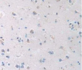 how to say glutathione Glutathione Peroxidase 4 Antibody (E5Y8K) Rabbit mAb main image 0