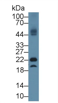 glutathione injection in coimbatore Anti-Glutathione Peroxidase 4 antibody (ab231174)