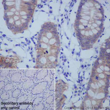 Immunohistochemistry (Formalin/PFA-fixed paraffin-embedded sections) - Anti-Glutathione Peroxidase 4 antibody [EPNCIR144] (AB125066)