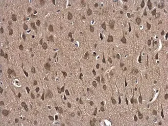Immunohistochemistry (Formalin/PFA-fixed paraffin-embedded sections) - Anti-Glutathione Reductase antibody (AB137513)