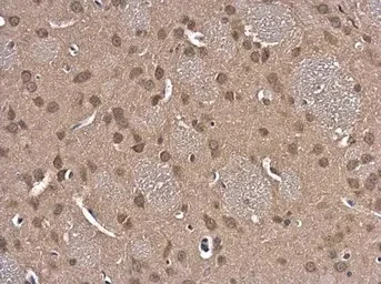 Immunohistochemistry (Formalin/PFA-fixed paraffin-embedded sections) - Anti-Glutathione Reductase antibody (AB137513)