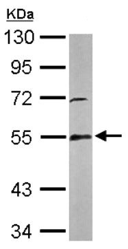 Western blot - Anti-Glutathione Reductase antibody (AB137513)