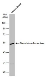 erythrocyte glutathione reductase activity coefficient Anti-Glutathione Reductase antibody (ab137513)
