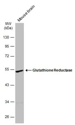 Western blot - Anti-Glutathione Reductase antibody (AB137513)
