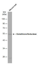 glutathione orac value Antioxidants and Their Measurement glutathione orac value Antioxidants and Their Measurement