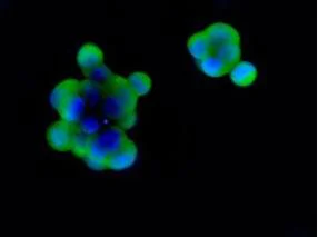 Immunocytochemistry/ Immunofluorescence - Anti-Glutathione Reductase antibody [EPR7237] (AB128933)