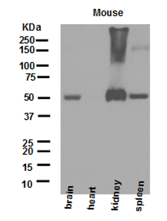glutathione reductase antibody Anti-Glutathione Reductase antibody [EPR7238] (ab124995)