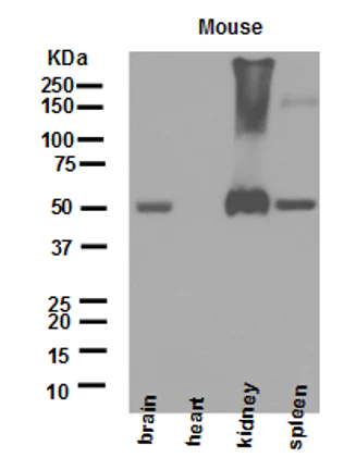 Western blot - Anti-Glutathione Reductase antibody [EPR7238] (AB124995)
