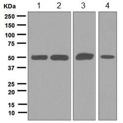Western blot - Anti-Glutathione Reductase antibody [EPR7238] (AB124995)
