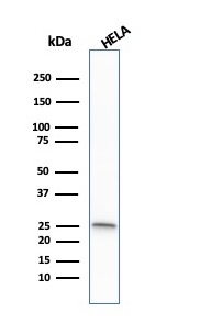 Western blot - Anti-Glutathione S Transferase mu antibody [CPTC-GSTMu1-3] (AB268069), expandable thumbnail