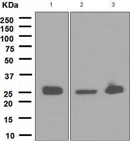Western blot - Anti-Glutathione S Transferase mu antibody [EPR1936(2)] (AB108524)