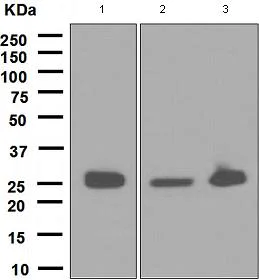 Western blot - Anti-Glutathione S Transferase mu antibody [EPR1936(2)] - BSA and Azide free (AB247682)