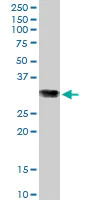 Western blot - Anti-glutathione S transferase Omega 1/p28 antibody (AB88604)