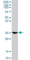 Western blot - Anti-glutathione S transferase Omega 1/p28 antibody (AB88604)