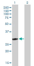 Anti-glutathione S transferase Omega 1/p28 antibody (ab88604)