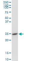 Western blot - Anti-glutathione S transferase Omega 1/p28 antibody (AB88604)