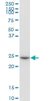 Western blot - Anti-glutathione S transferase Omega 1/p28 antibody (AB88604)