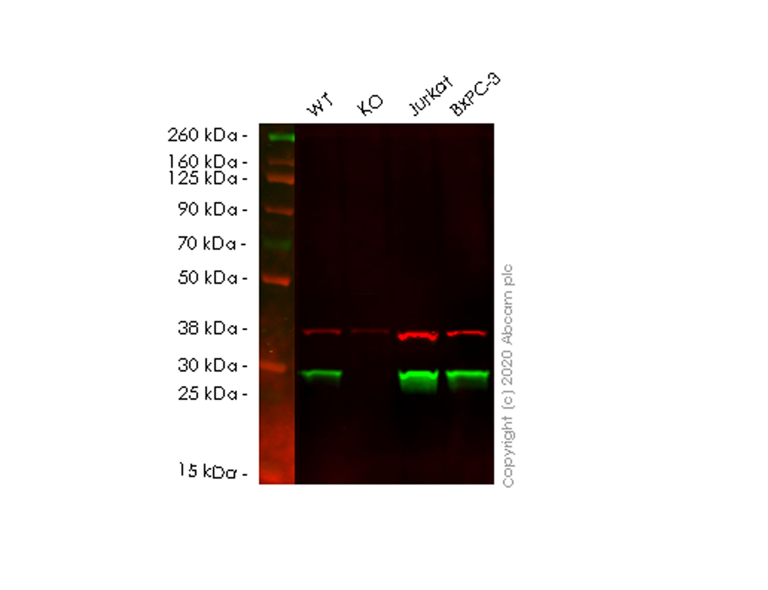 Western blot - Anti-glutathione S transferase Omega 1/p28 antibody [EPR8370(B)] (AB129106), expandable thumbnail