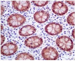 Immunohistochemistry (Formalin/PFA-fixed paraffin-embedded sections) - Anti-Glutathione Synthetase antibody [EPR6563] - BSA and Azide free (AB236062)