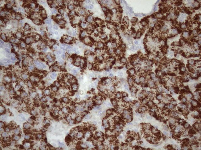 Immunohistochemistry (Formalin/PFA-fixed paraffin-embedded sections) - Anti-GLYAT/GAT antibody [OTI4D1] (AB279369)