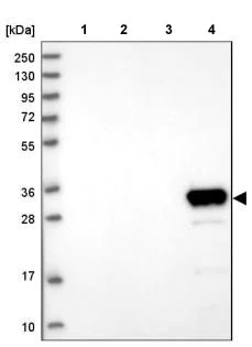 Western blot - Anti-GLYATL1 antibody (AB187859)