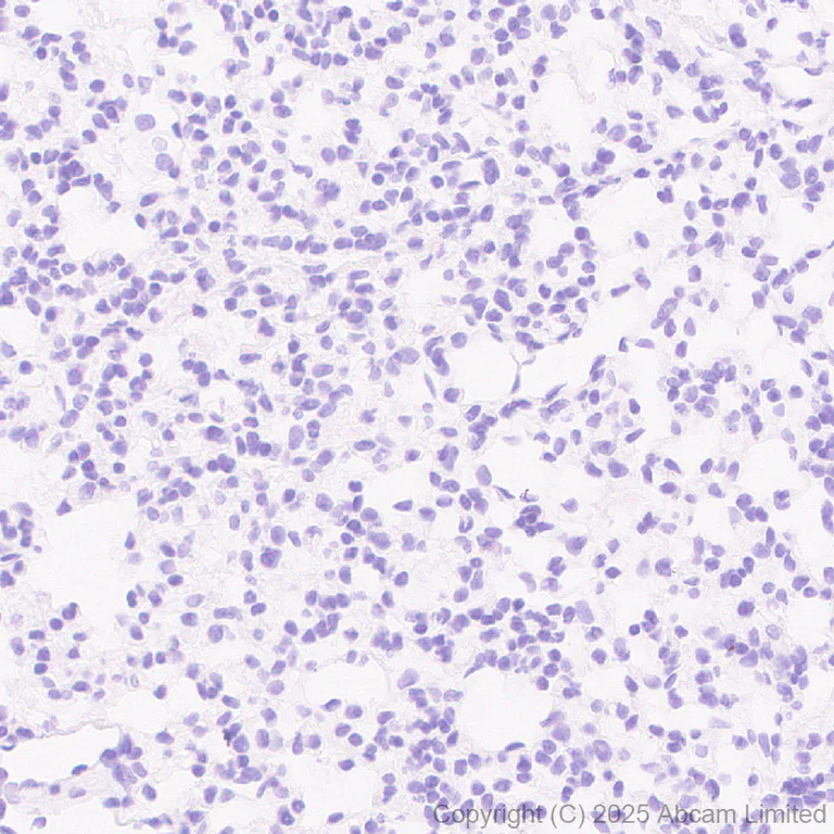 Immunohistochemistry (Formalin/PFA-fixed paraffin-embedded sections) - Anti-Glycam1 antibody [EPR30103-507] (AB324912)