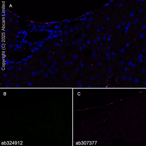 Immunohistochemistry (Frozen sections) - Anti-Glycam1 antibody [EPR30103-507] (AB324912)