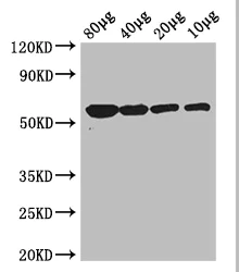 Western blot - Anti-Glycerol kinase antibody (AB193521)