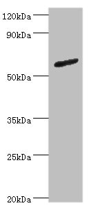 Western blot - Anti-Glycerol kinase antibody (AB193521)