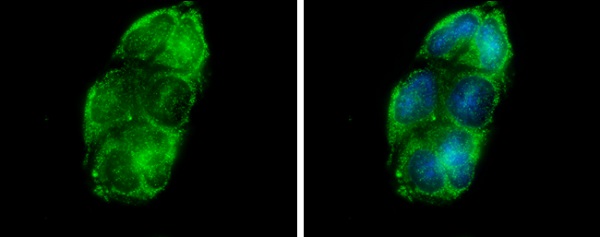 Immunocytochemistry/ Immunofluorescence - Anti-Glycerol kinase antibody (AB228615)