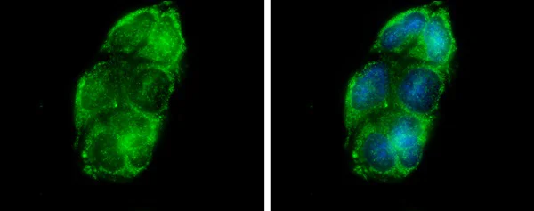 Immunocytochemistry/ Immunofluorescence - Anti-Glycerol kinase antibody (AB228615)
