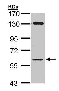 Western blot - Anti-Glycerol kinase antibody (AB228615)