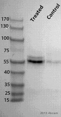 Western blot - Anti-Glycerol kinase antibody [EPR6567] (AB126599)
