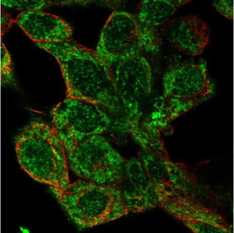 Immunocytochemistry/ Immunofluorescence - Anti-Glycine decarboxylase antibody (AB204087)
