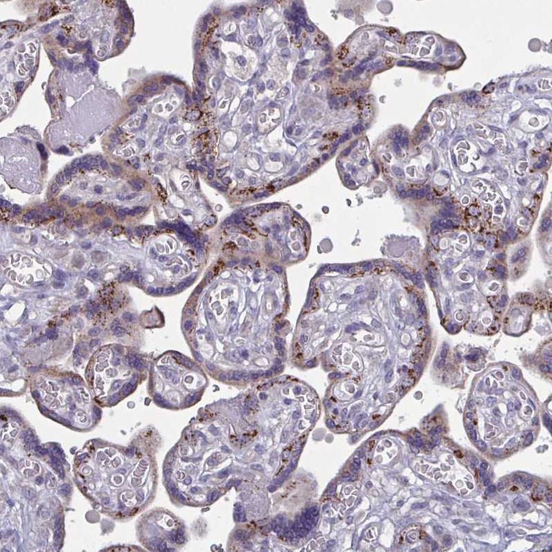 Immunohistochemistry (Formalin/PFA-fixed paraffin-embedded sections) - Anti-Glycine decarboxylase antibody (AB204087)