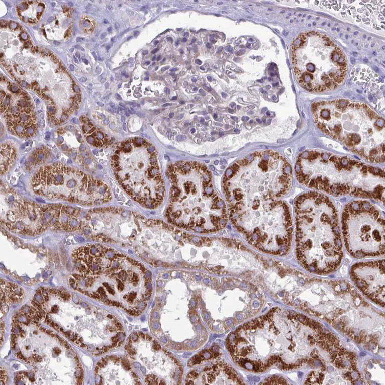 Immunohistochemistry (Formalin/PFA-fixed paraffin-embedded sections) - Anti-Glycine decarboxylase antibody (AB204087)