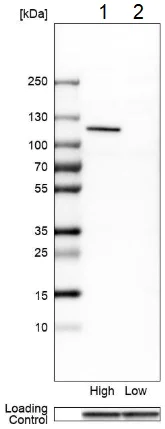 Western blot - Anti-Glycine decarboxylase antibody (AB204087)