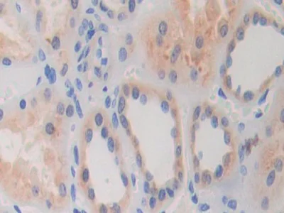 Immunohistochemistry (Formalin/PFA-fixed paraffin-embedded sections) - Anti-Glycine decarboxylase antibody (AB232989)