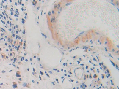 Immunohistochemistry (Formalin/PFA-fixed paraffin-embedded sections) - Anti-Glycine decarboxylase antibody (AB232989)