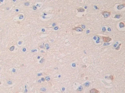 Immunohistochemistry (Formalin/PFA-fixed paraffin-embedded sections) - Anti-Glycine decarboxylase antibody (AB232989)