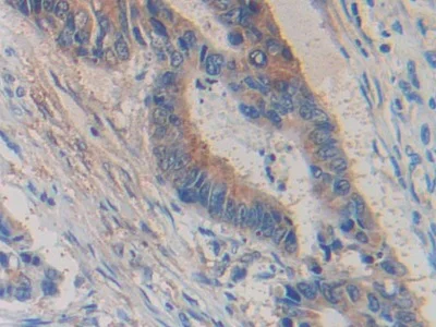 Immunohistochemistry (Formalin/PFA-fixed paraffin-embedded sections) - Anti-Glycine decarboxylase antibody (AB232989)